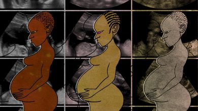 Learning the African history of caesarean sections will help us better challenge stigma